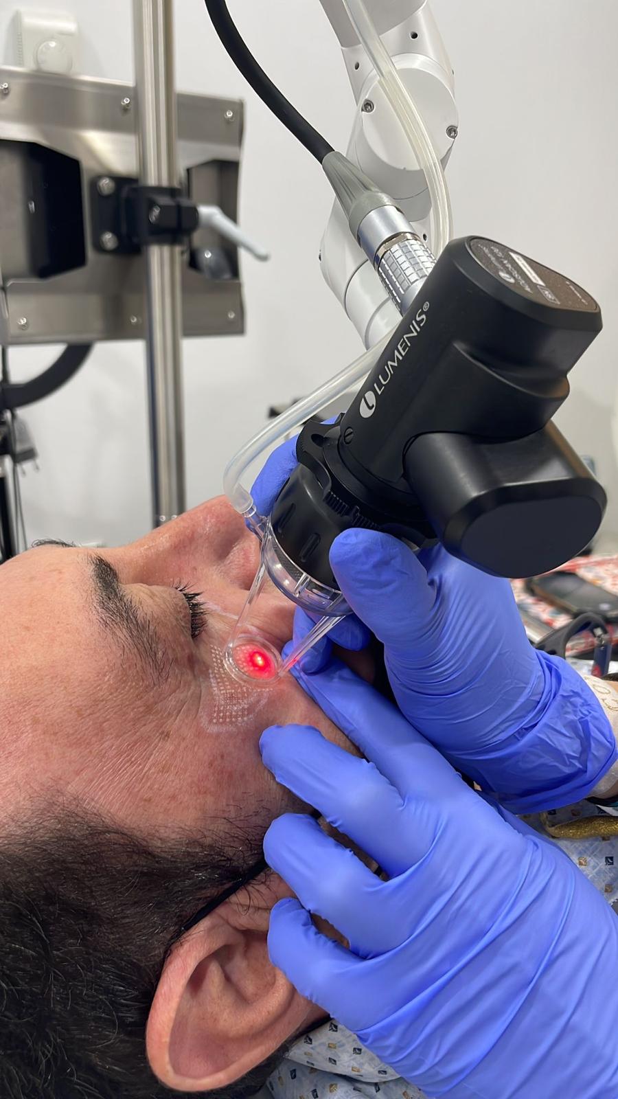 laser co2 resurfacing doctora maria miranda